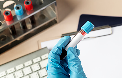 Forensic Blood Testing – Winning Wednesday May 13, 2020